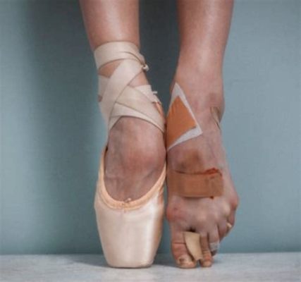 do ballet dancers have bad feet? and do they also have perfect posture?